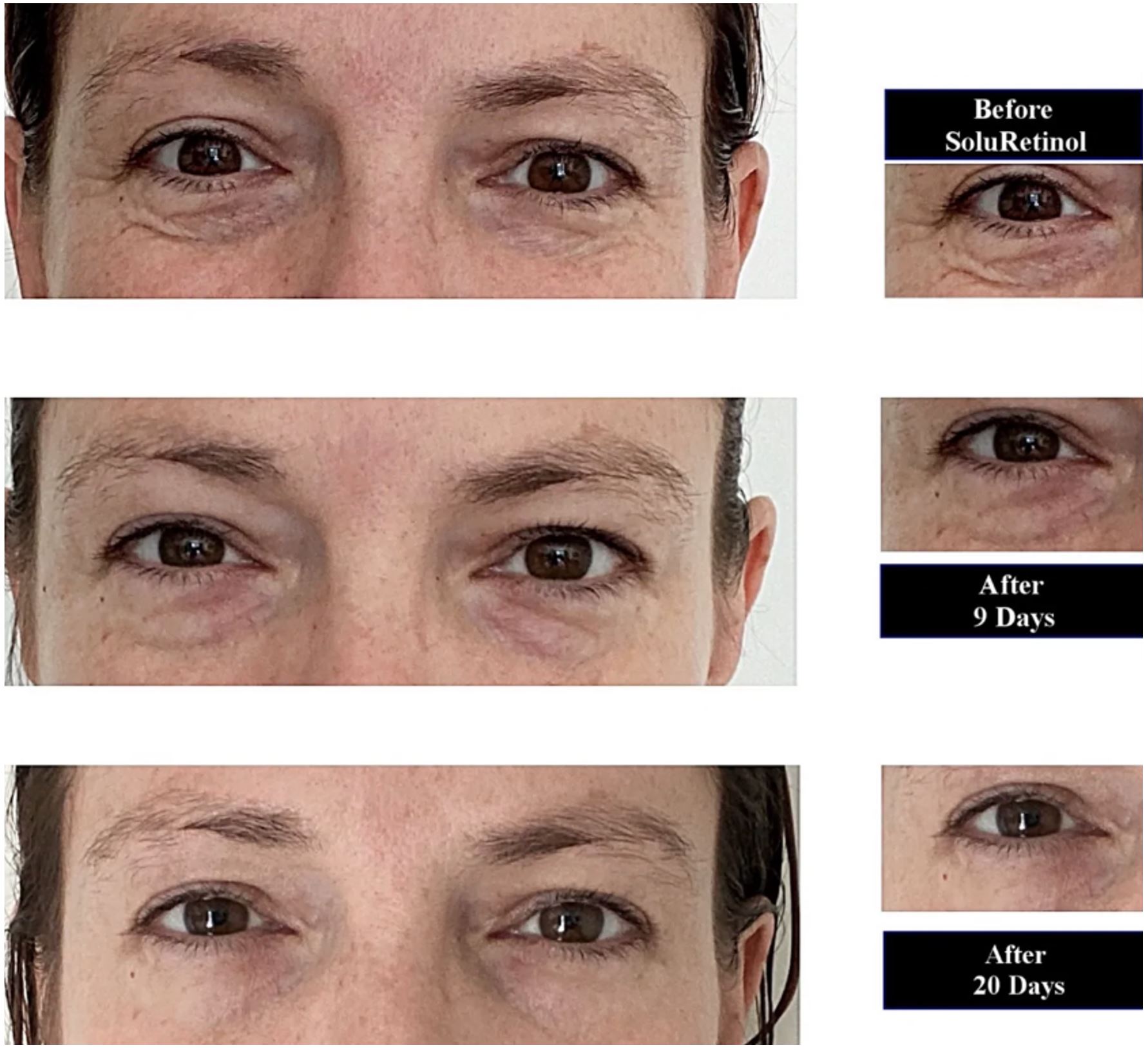 42 Year Old Woman After 20 Days